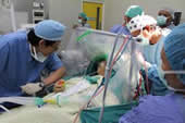awake-craniotomy